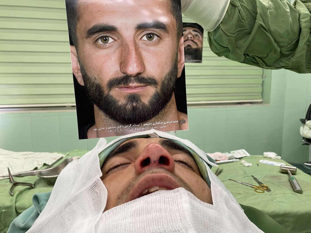 جراحی انحراف بینی در شیراز