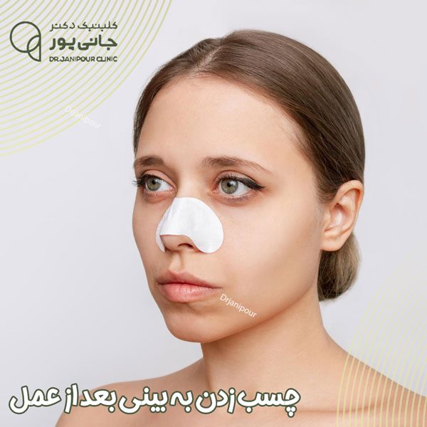 فیلم نحوه چسب زدن بینی استخوانی