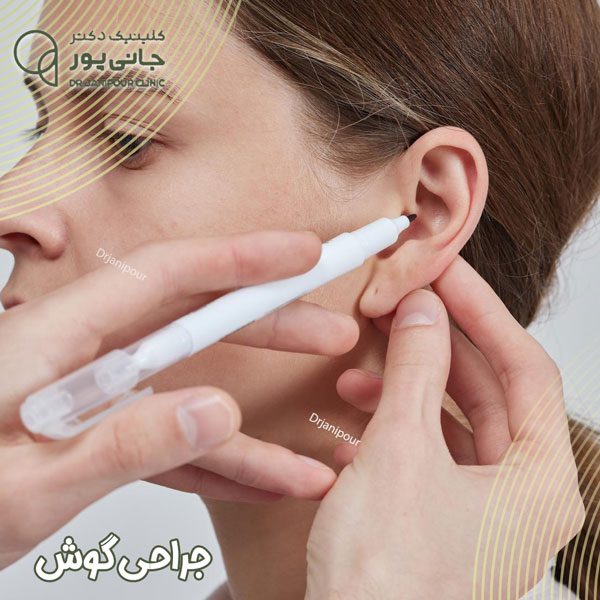 جراحی گوش در شیراز - دکتر جانی پور
